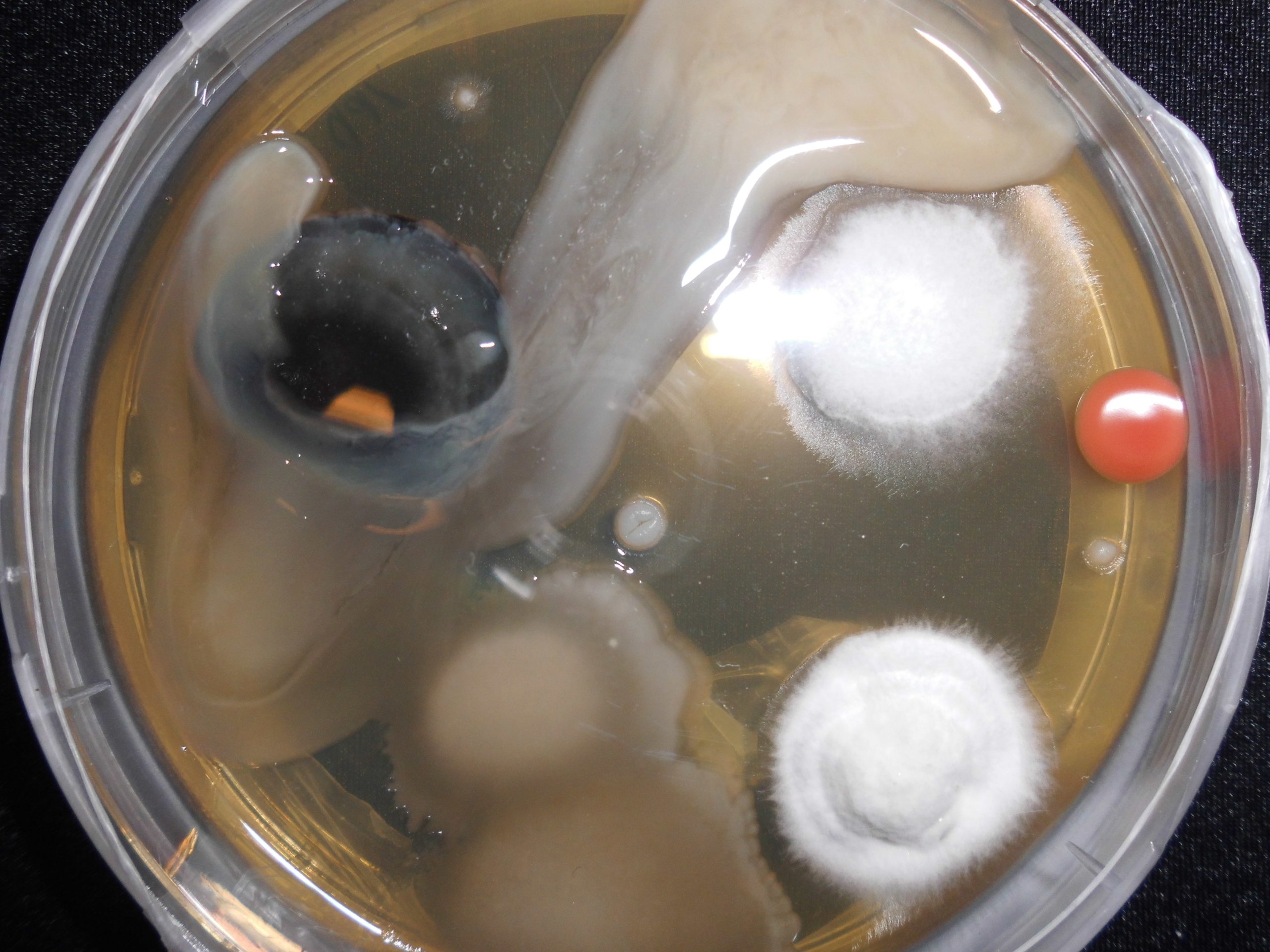 Contamination on an agar plate showing why clean technique matters