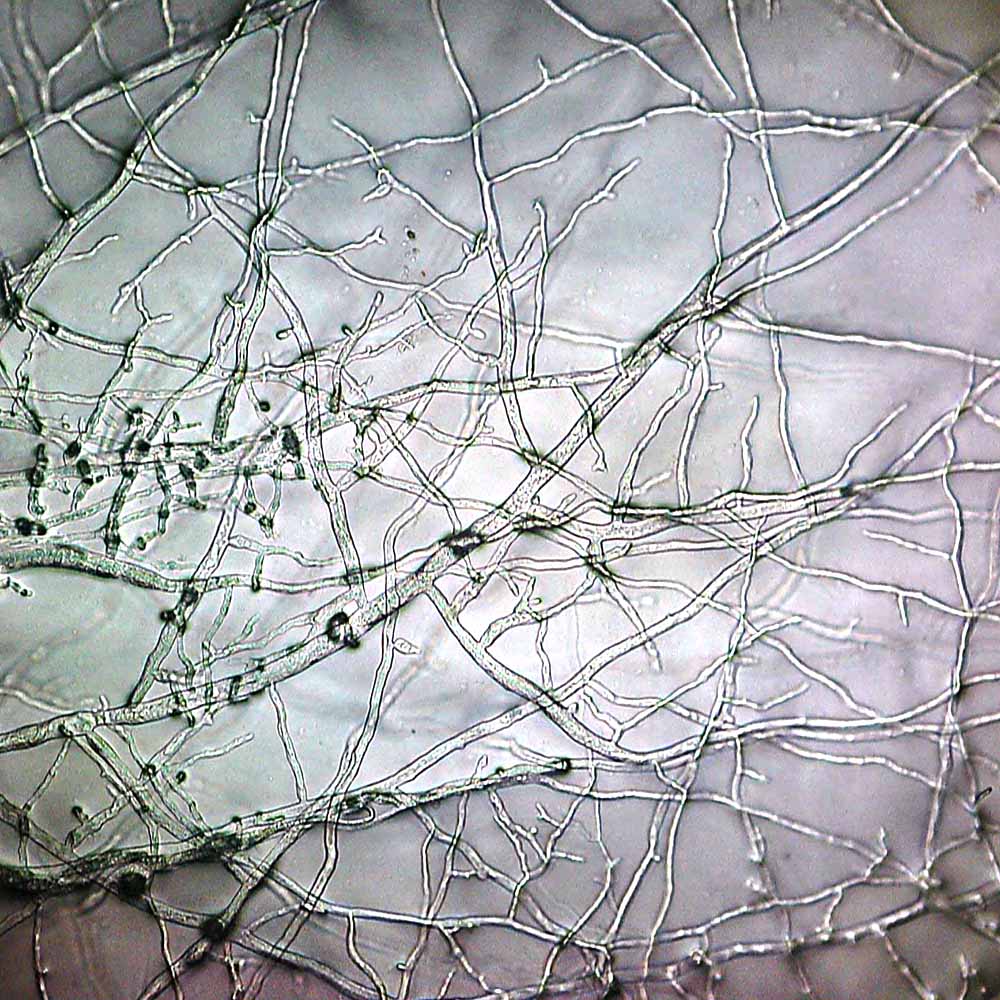 Mold growing in a petri dish, illustrating contamination