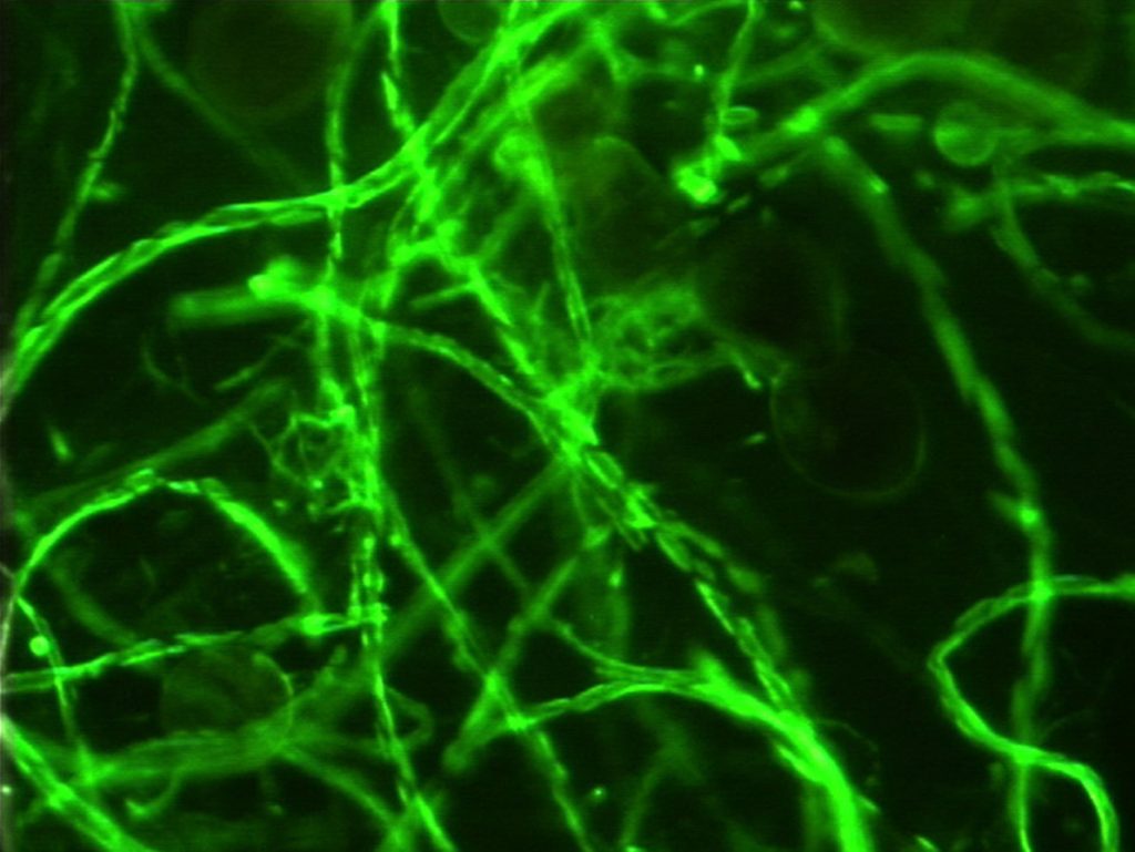 Microscope view of thin mycorrhizal fungal hyphae with glomalin highlighted as bright green spots
